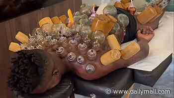 Man United flop shows off bizarre recovery method which involves using FIRE to aid his recovery