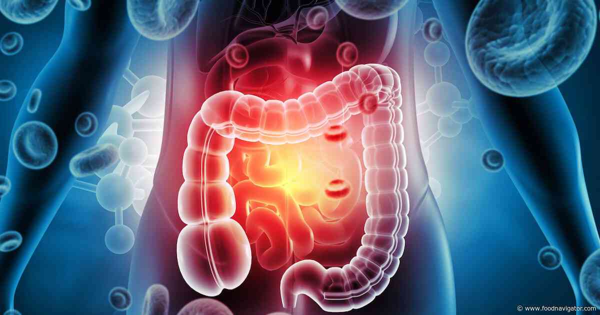 Sweeteners and the microbiome: What do we know?