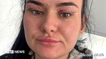 Open wounds and eyes that can't close - women warn about cheap bleph eyelid surgery