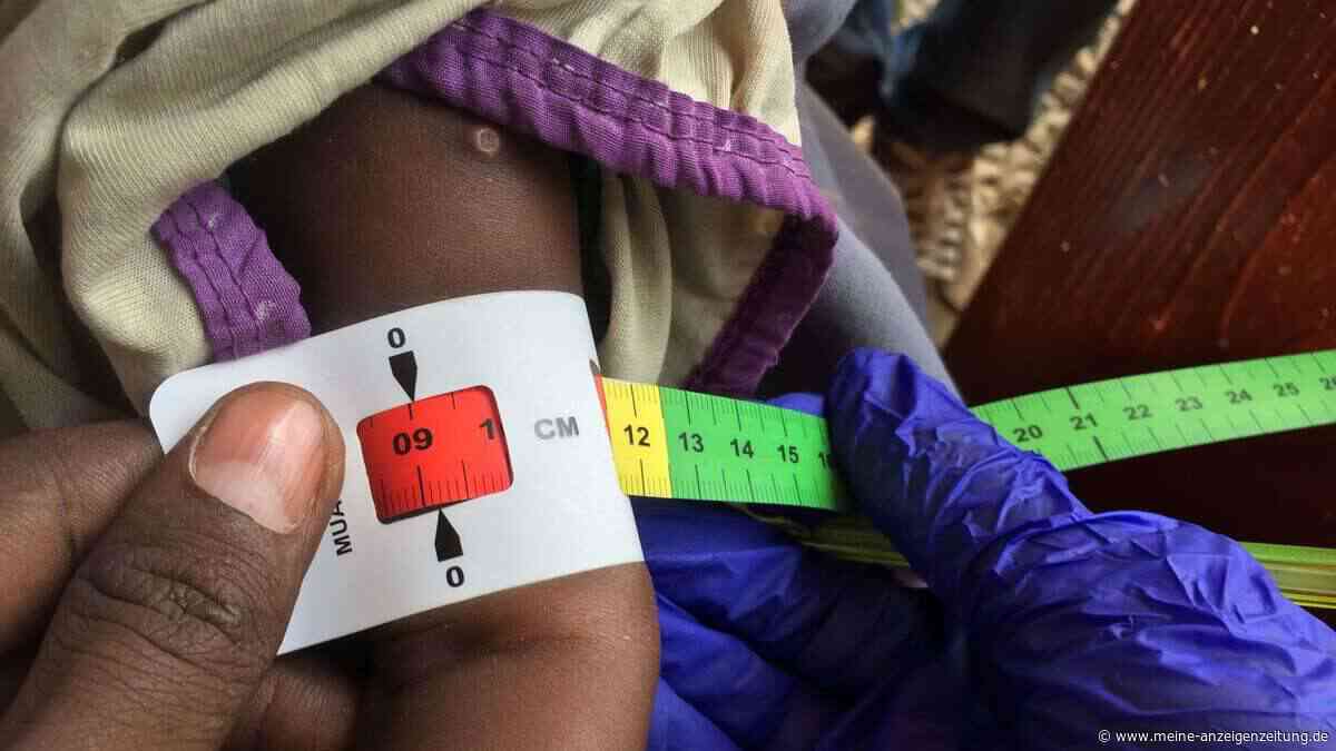 Bericht sieht Risiko einer Hungersnot in Teilen Somalias