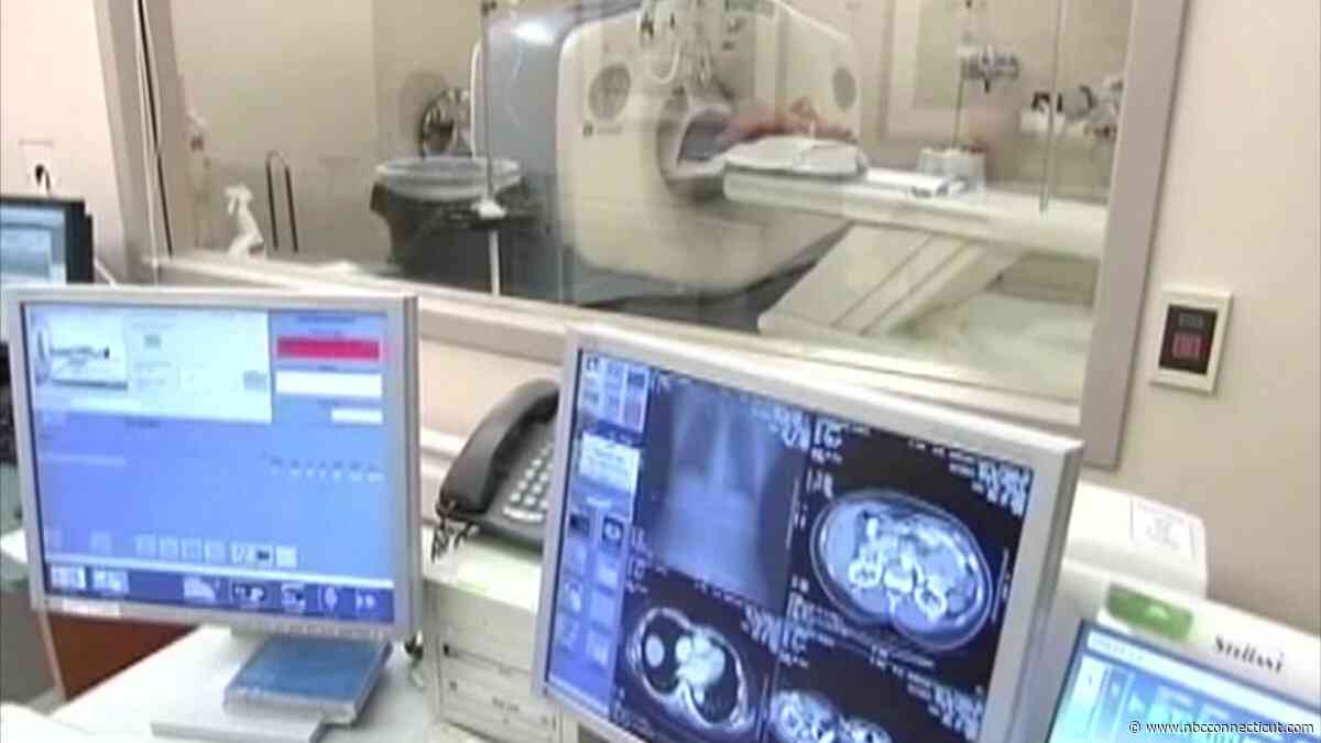 Cancer diagnoses are rising in people under 50. When should you get screened?