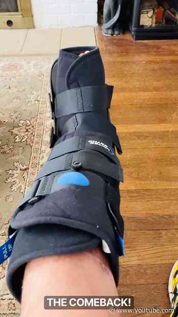 BAD Accident BROKE my Tibia (shinbone) 3 Fractures total…