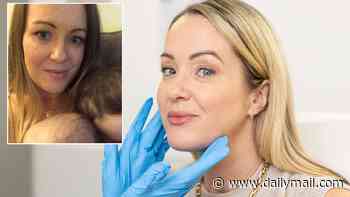 I've used my fair share of Botox but it can only really do one job... so a year ago, I decided to go a step further and find out: Can salmon sperm injections REALLY make me look better aged 47 than I did at 37?