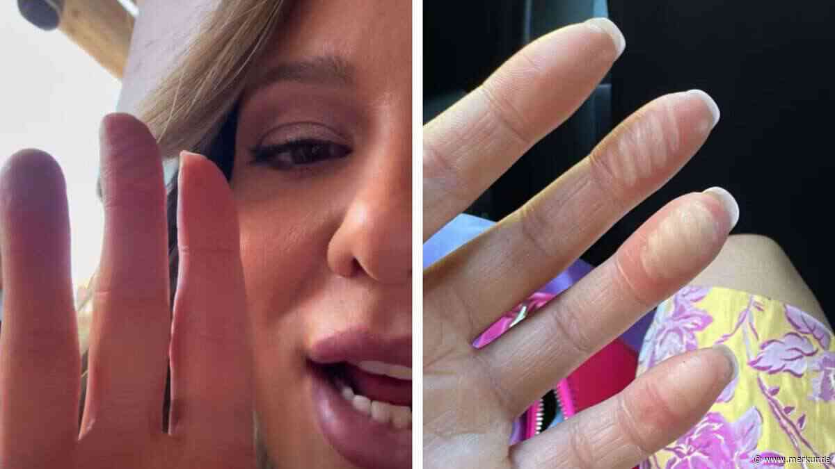 „Grill-Händel“: Schlagersängerin Joelina Drews verbrennt sich bei Wiesn-Besuch die Finger