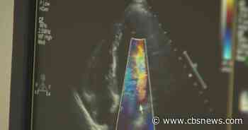 What you should know about atrial fibrillation
