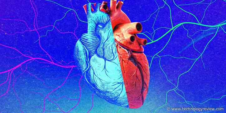 Young organs may not be a fountain of youth for recipients
