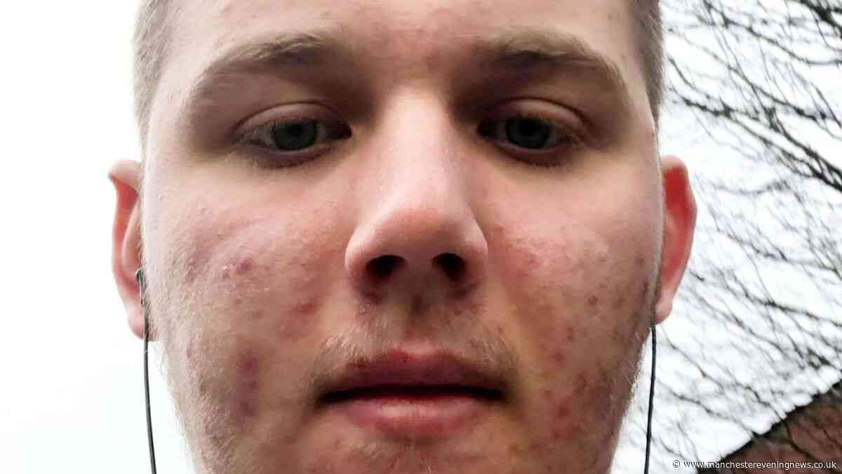 Bolton man, 25, who weighed 150kg and didn't leave home for months over severe acne is now Mr England finalist in incredible transformation