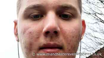 Bolton man, 25, who weighed 150kg and didn't leave home for months over severe acne is now Mr England finalist in incredible transformation