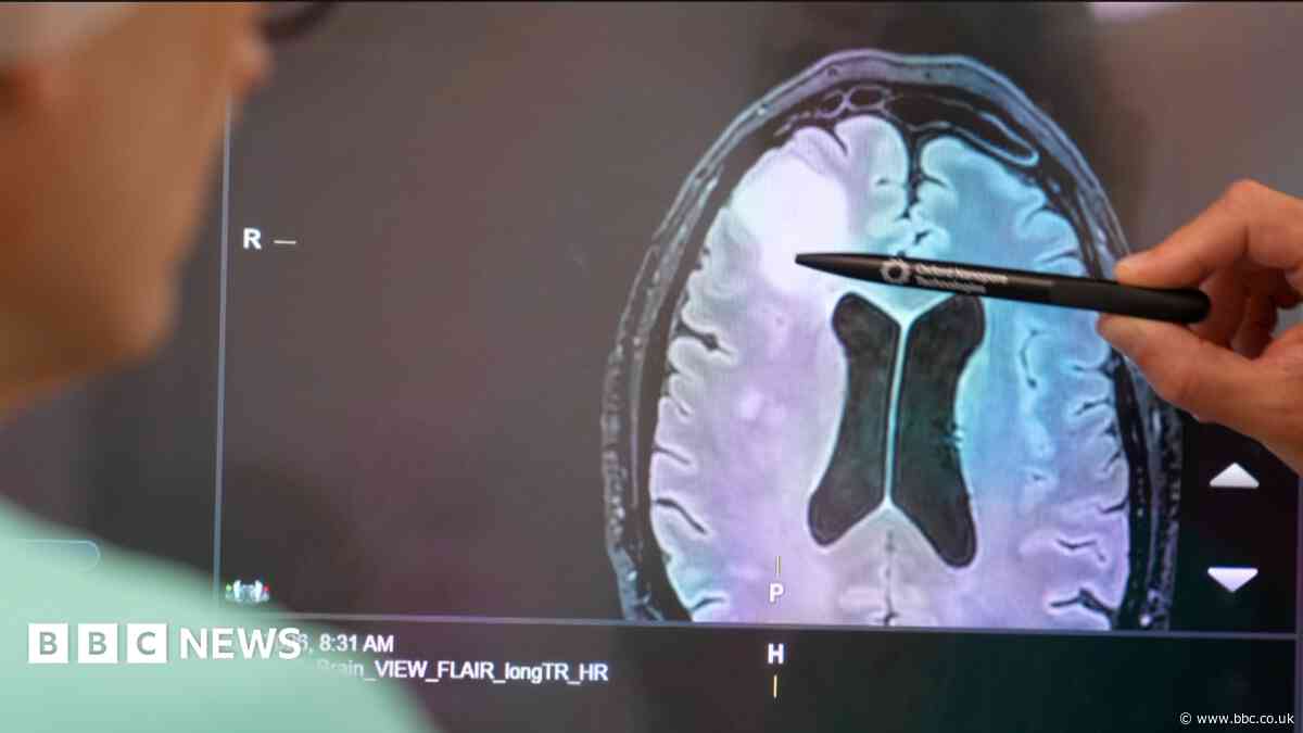 Test could 'revolutionise brain tumour diagnosis'