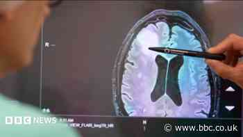 Test could 'revolutionise brain tumour diagnosis'