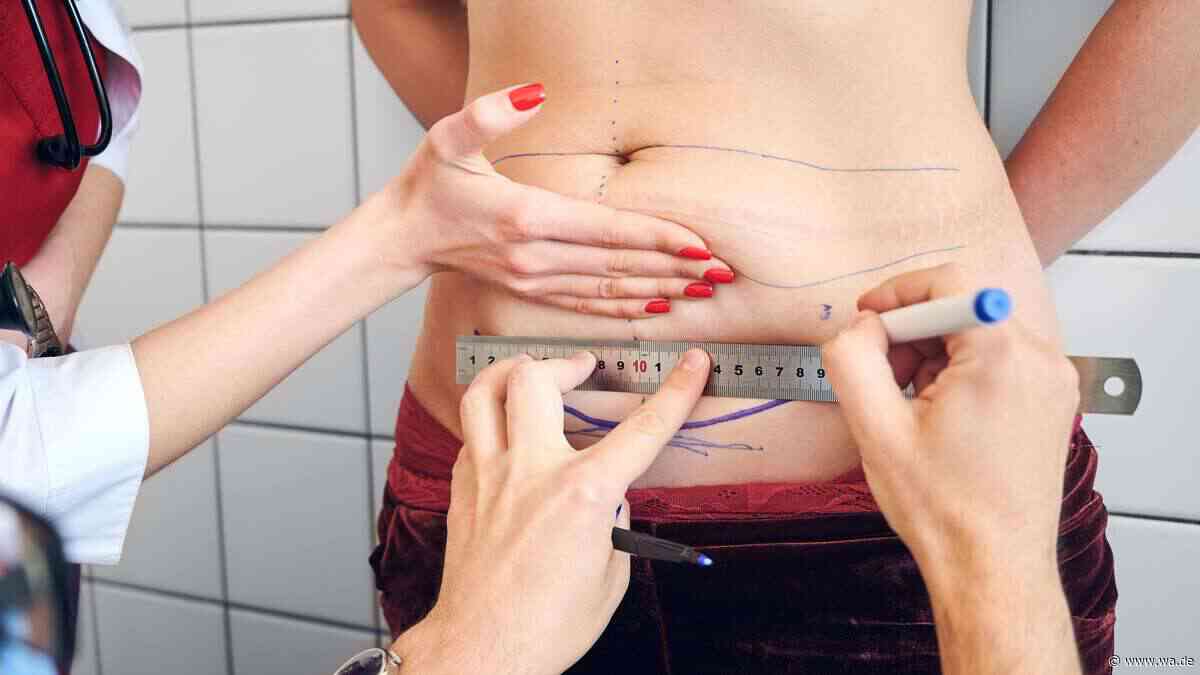 Nach der Abnehmspritze: Was passiert mit überschüssiger Haut?