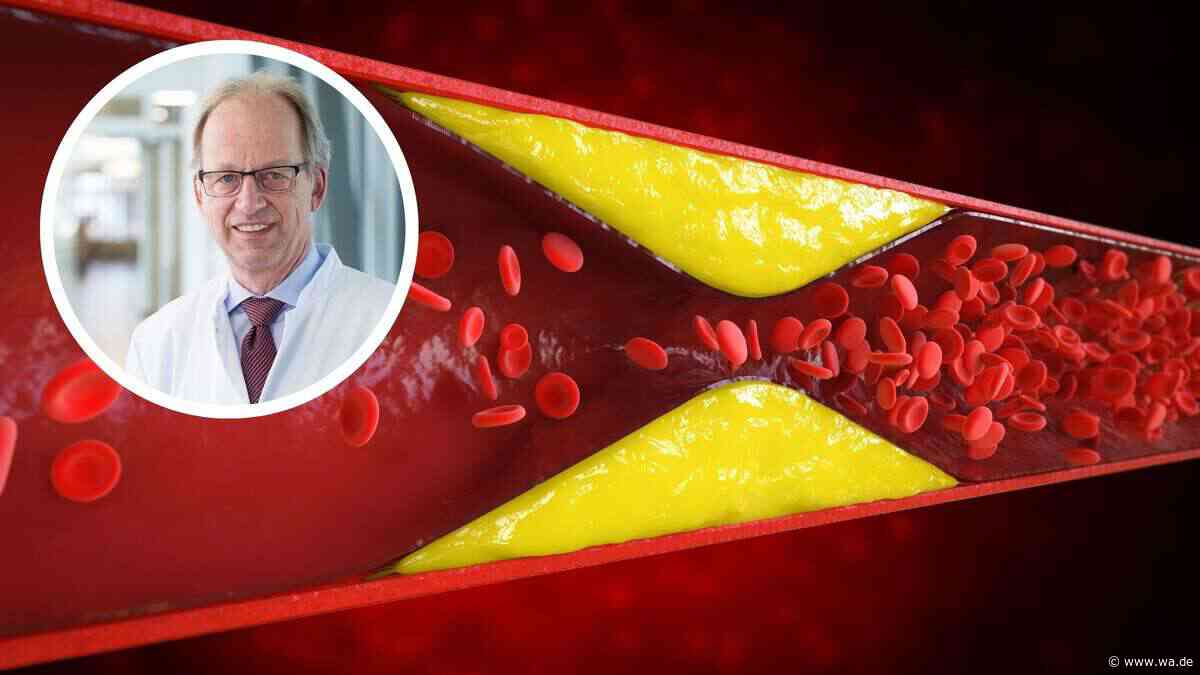 Gefäßputzer-Plan: LMU-Mediziner erklärt, wie sich Plaques vermeiden und zurückbilden lassen