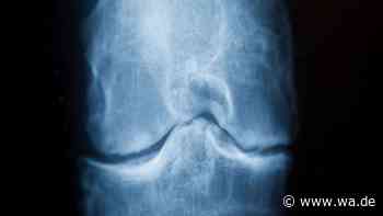 Kollagen bei Arthrose? Es kann helfen, nur anders, als viele denken