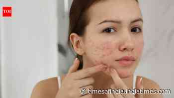 Pigmentation, acne scars or ageing? 5 questions that can help identify the right treatment path