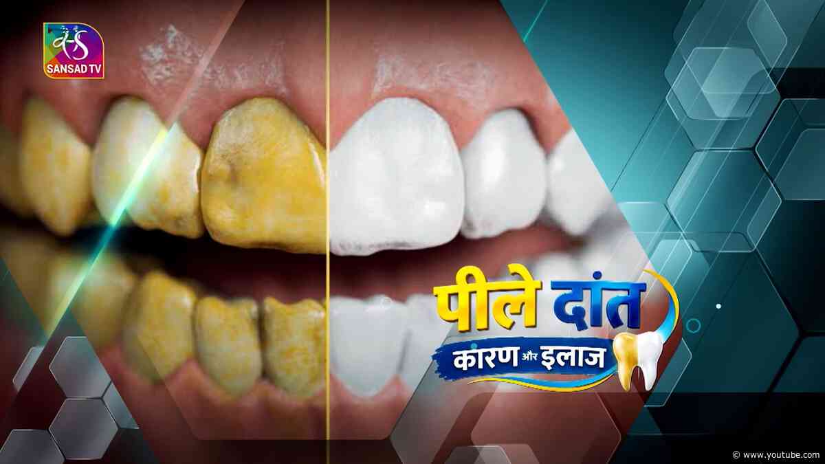 Ayushman Bhava: Yellow Teeth  | Episode - 54 | 26 September, 2026