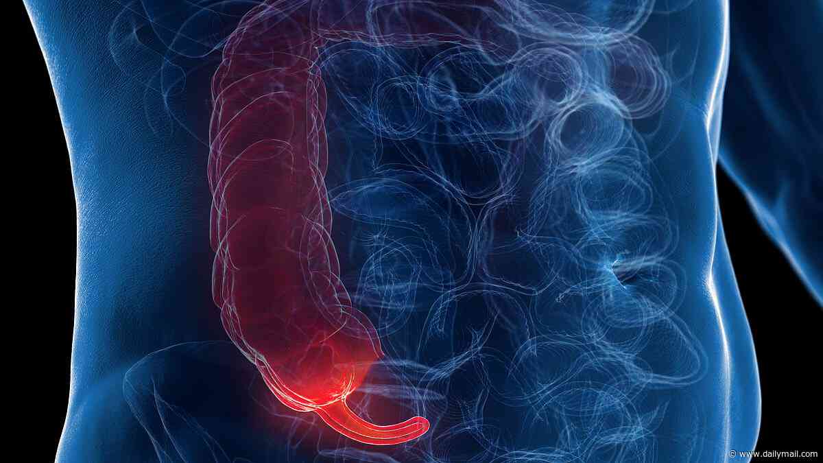 Inside the rise of appendix cancer in under-50s as statistics show a dramatic increase in the number of young and middle-aged people being diagnosed