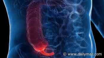 Inside the rise of appendix cancer in under-50s as statistics show a dramatic increase in the number of young and middle-aged people being diagnosed