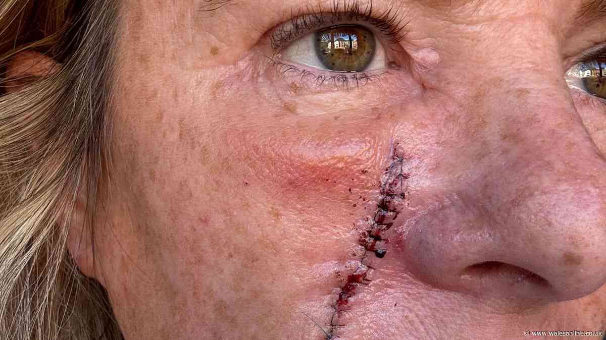 'They told me it was just an ingrown hair but the truth was far worse'