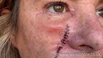 'They told me it was just an ingrown hair but the truth was far worse'