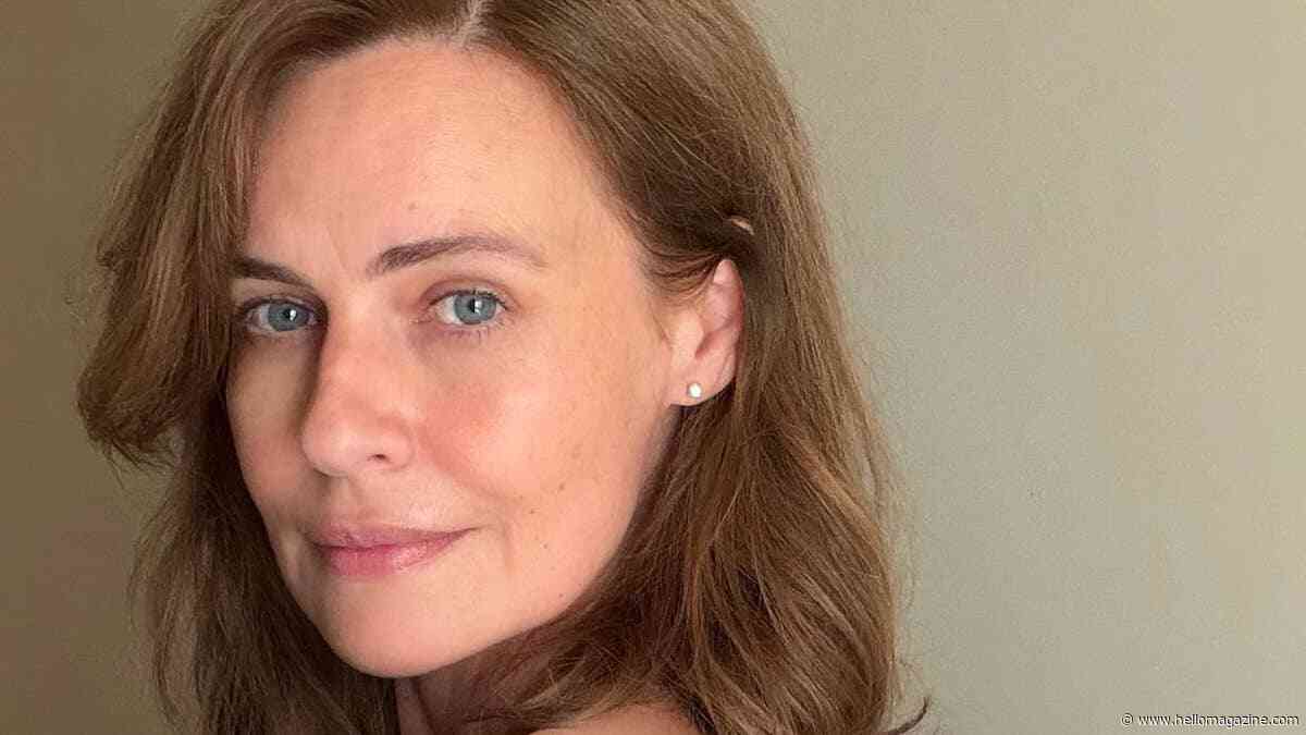 At 50, I was terrified to have filler. Here's what changed