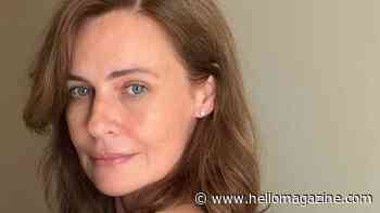 At 50, I was terrified to have filler. Here's what changed