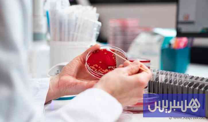 دراسة مغربية: "فحص مخبري سريع" يكشف مسببات ال