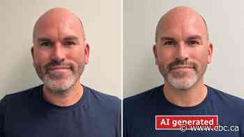 Can I get AI face? Plastic surgeons say AI-generated inspiration is more than meets the eye