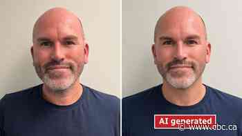 Can I get AI face? Plastic surgeons say AI-generated inspiration is more than meets the eye