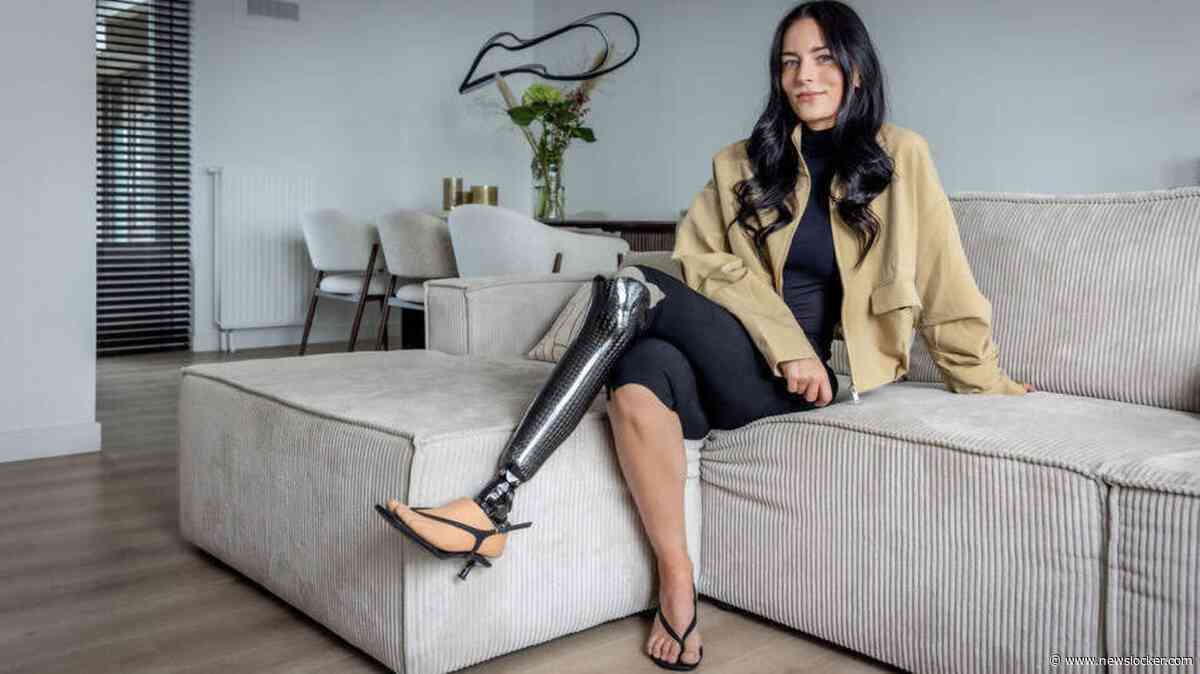 Manon (27) draagt haar beenprothese met trots: ’Als een ander me ziet en het daarna ook durft, daar doe ik het voor’