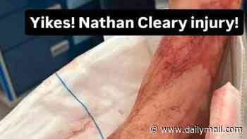 GRAPHIC IMAGE WARNING: The shocking true extent of Nathan Cleary's broken leg revealed - as Penrith champion calls on trolls to leave tackler alone