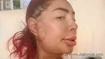 Farrah Abraham now totally unrecognizable as she unveils disfigured face after brutal procedure