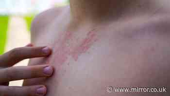 UKHSA 'early action matters' alert over contagious disease
