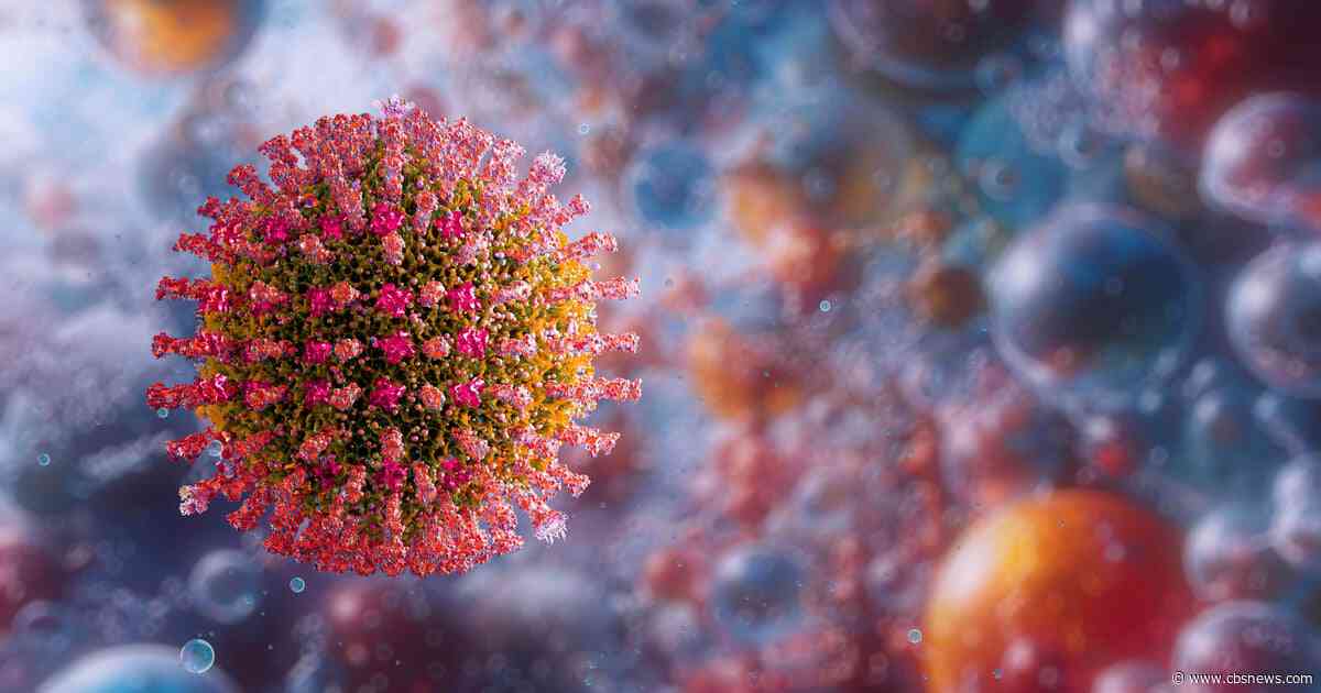 Georgia measles cases hit 21 in 2026, with 5 new cases connected to Jasper County family