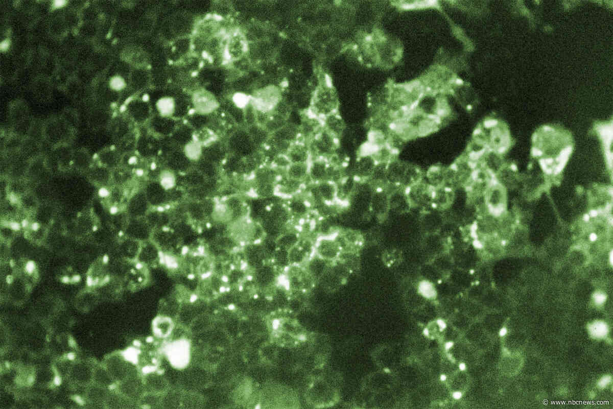 Pennsylvania reports 5th measles-related death in the state