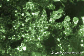 Pennsylvania reports 5th measles-related death in the state