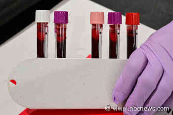 Iron deficiency often goes undiagnosed and untreated. New guidelines could change that.