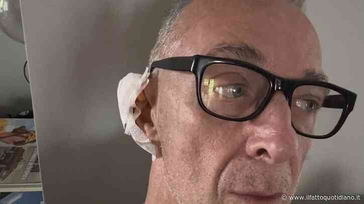 “Mi vedrete così, in stile Van Gogh. La causa si chiama epitelioma, una cosa molto comune ma da non sottovalutare”: Linus e la medicazione all’orecchio