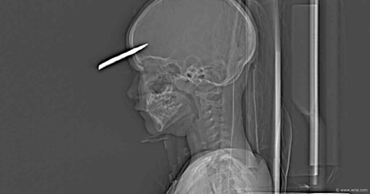 Axe, rake, dog injuries: Father shares frustrations pulling kids out of dangerous Chapel Hill home