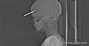 Axe, rake, dog injuries: Father shares frustrations pulling kids out of dangerous Chapel Hill home