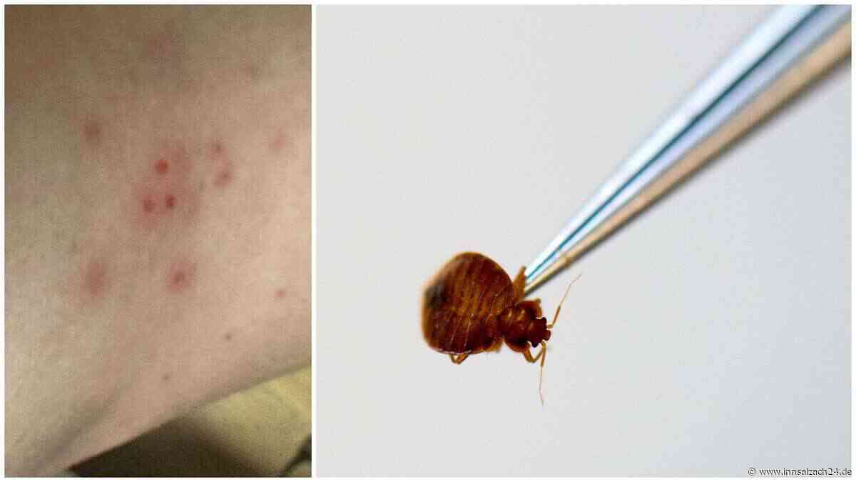 Erst der Biss, dann der Betrug? Zangbergerin warnt vor dubioser Kammerjäger-Masche