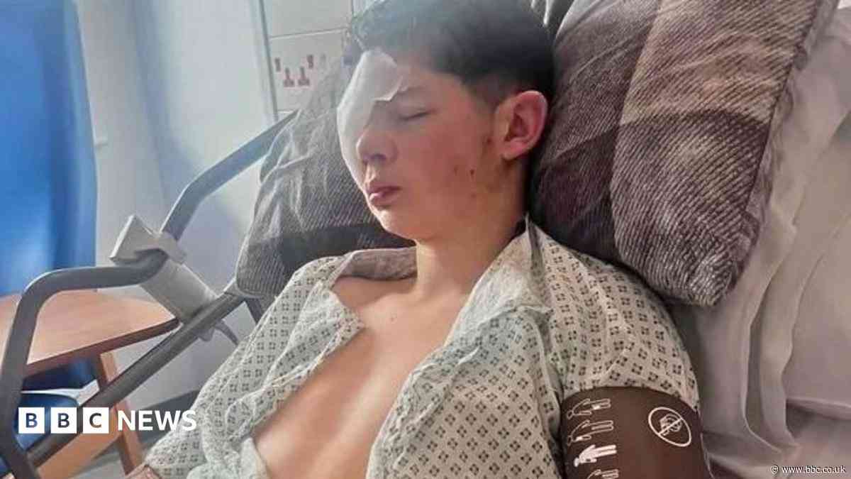 'Utter shock' for teen who lost eye in glass attack