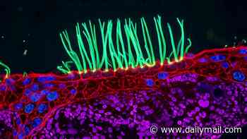 Huge row over microscope photograph contest winner's 'AI fake' video