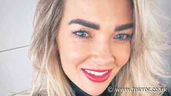 Woman, 34, suffered bloating for 20 years before a test and diet change finally solved it