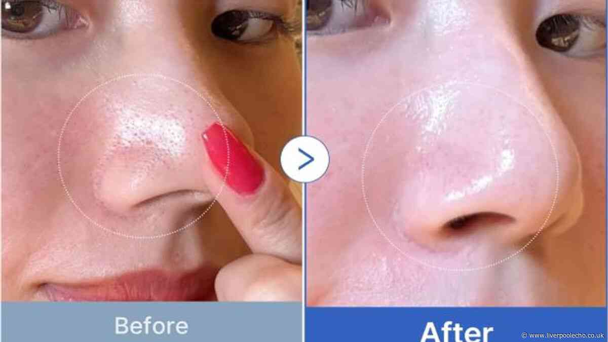 Boots shoppers race to buy viral Korean 'pore blurring' pads in flash sale