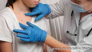 NHS list of Hepatitis A symptoms after cases confirmed at Newcastle primary schools
