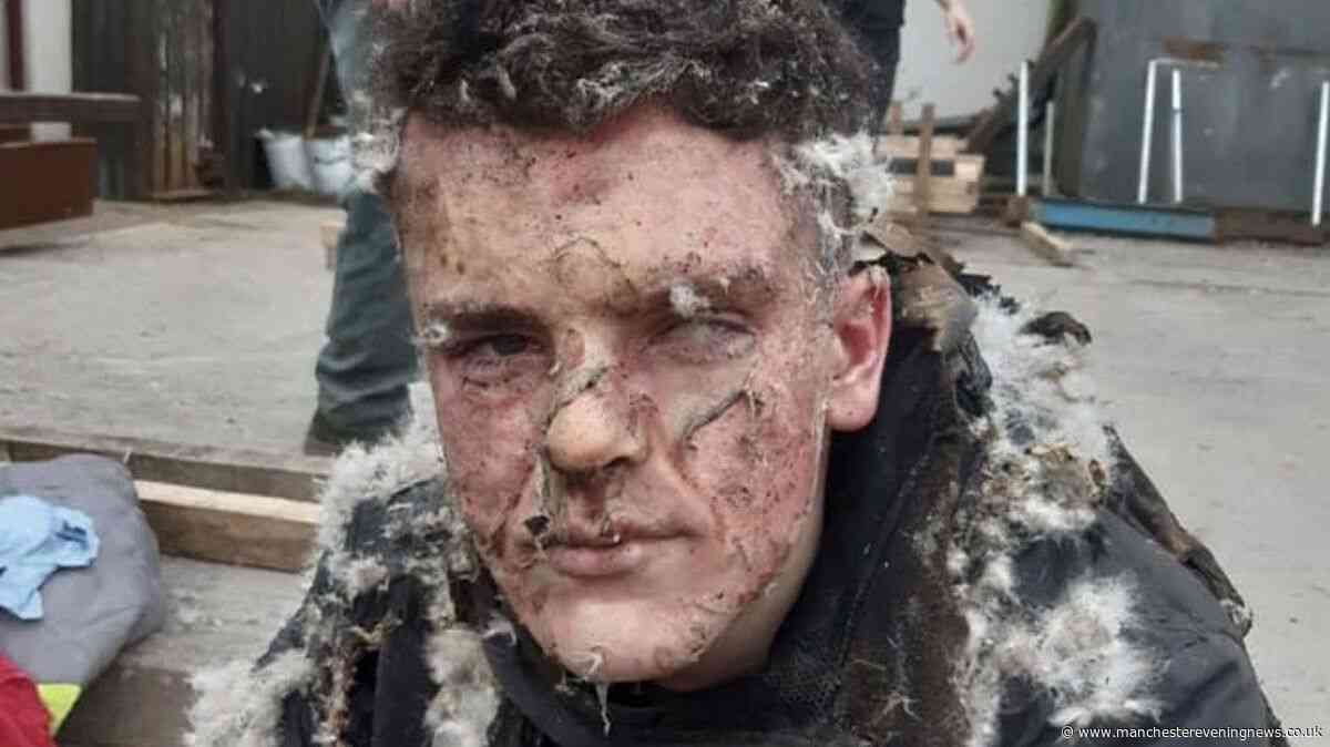 Six figure pay-out for Wigan teen who begged 'let me die' after workplace horror blast