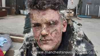 Six figure pay-out for Wigan teen who begged 'let me die' after workplace horror blast