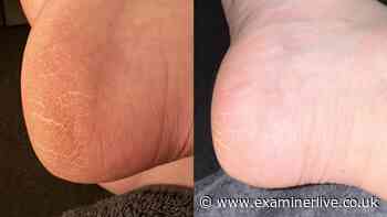 Women swap £40 pedicures for £12 scrub leaving 'feet and legs incredibly soft'