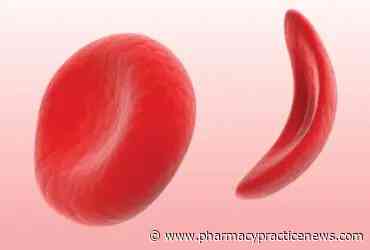 The Ongoing Struggle of Sickle Cell Disease