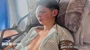 'Utter shock' for teen who lost eye in glass attack
